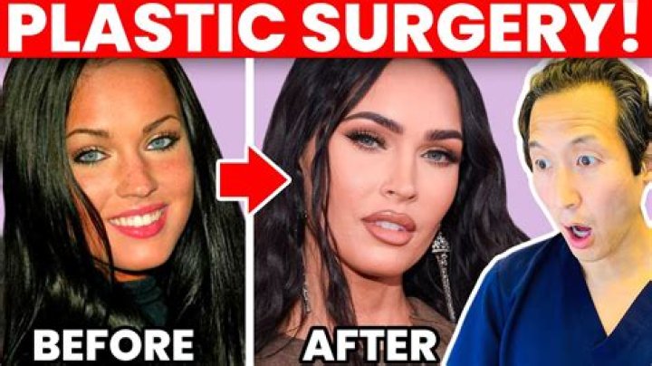 A Look into Megan Fox’s Plastic Surgery Rumors — Has She Gone under the Knife?
