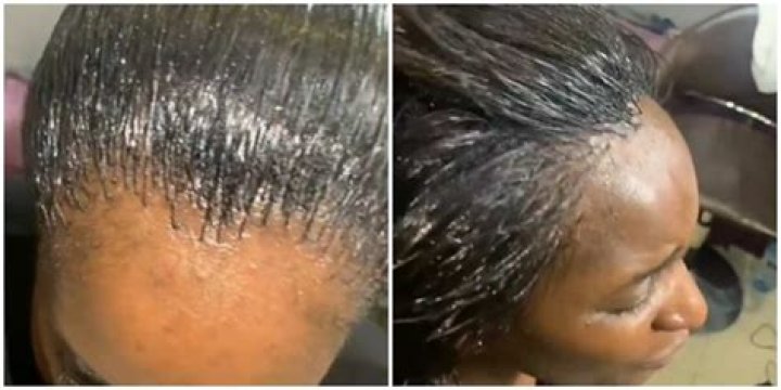 "Bye Bye Front Hair": Trending Video of Lady with Extra Tiny Braids Sparks Reactions