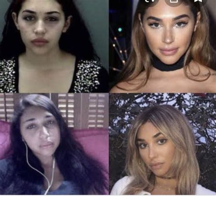 Chantel Jeffries Plastic Surgery Before And After