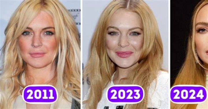 Forget The Lindsay Lohan Comparisons — Emma Stone Is Already WAY Better Than Lindsay Ever Was! – Hollywood Life