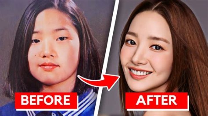 Has Cho Yeo-jeong ever undergone plastic surgery? Secret to her evergreen beauty revealed