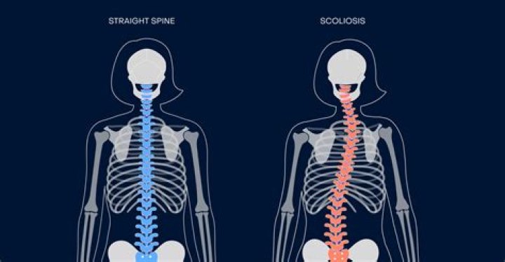 Jennifer Ngo Before Surgery: Face Condition And Scoliosis Update