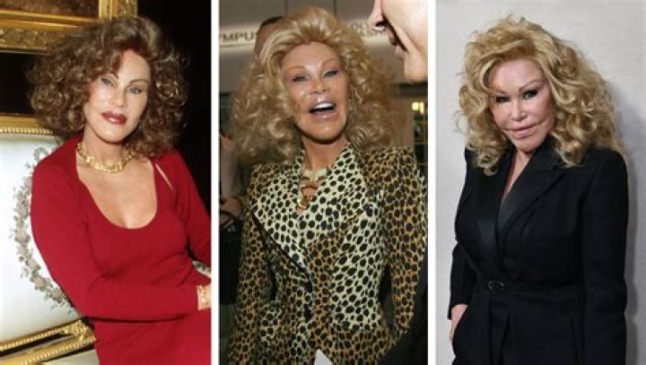Jocelyn Wildenstein