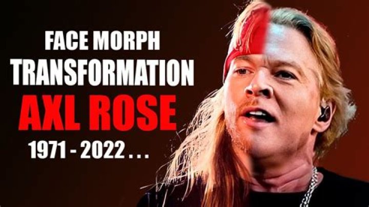 Photos: What Happened To Axl Rose Face? Plastic Surgery And Botox