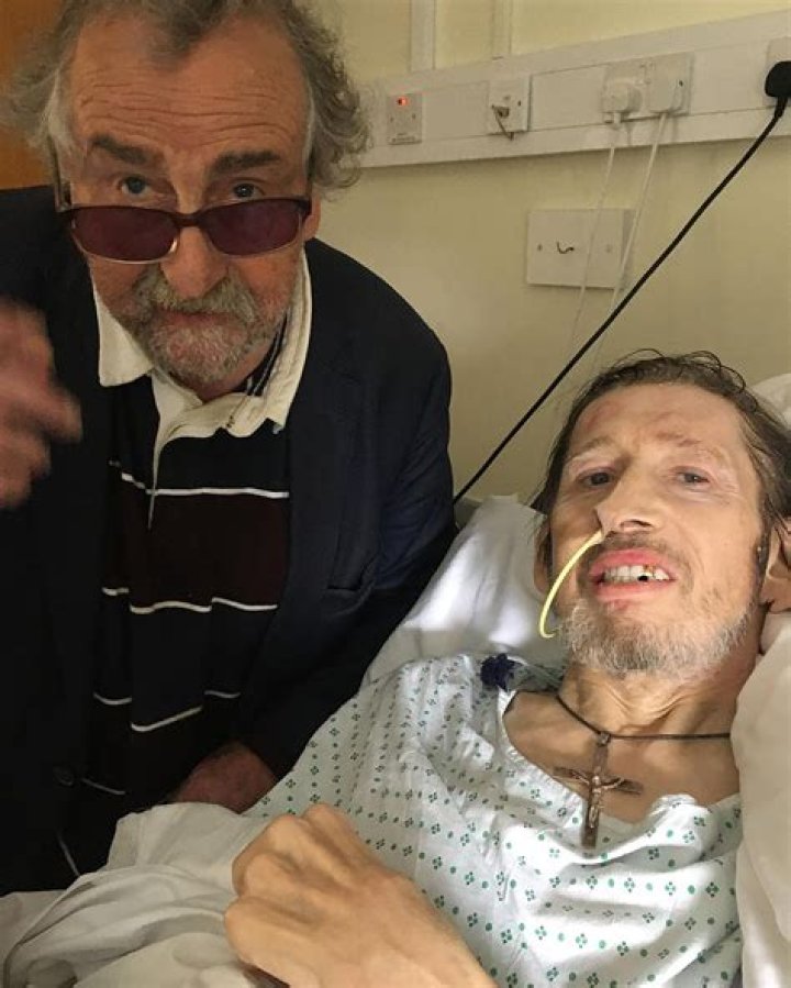 Shane MacGowan Nose Job: Did He Ever Get Plastic Surgery?