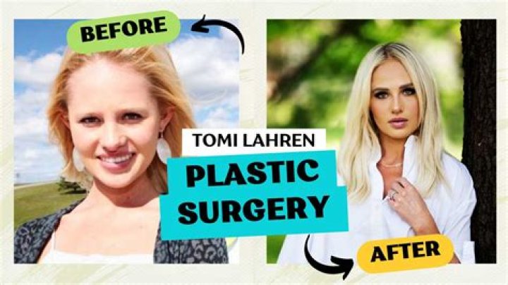 Sybil Lau Tattoo: Plastic Surgery Rumors