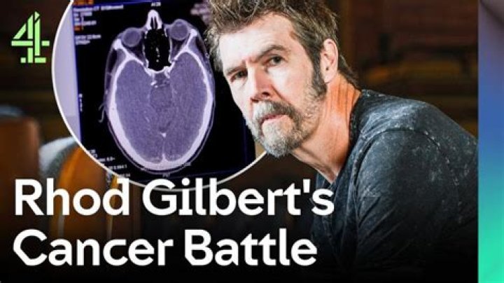 
What Type Of Cancer Does Rhod Gilbert Have? Has He Had Stroke? Comedian Reveals His Battle 
